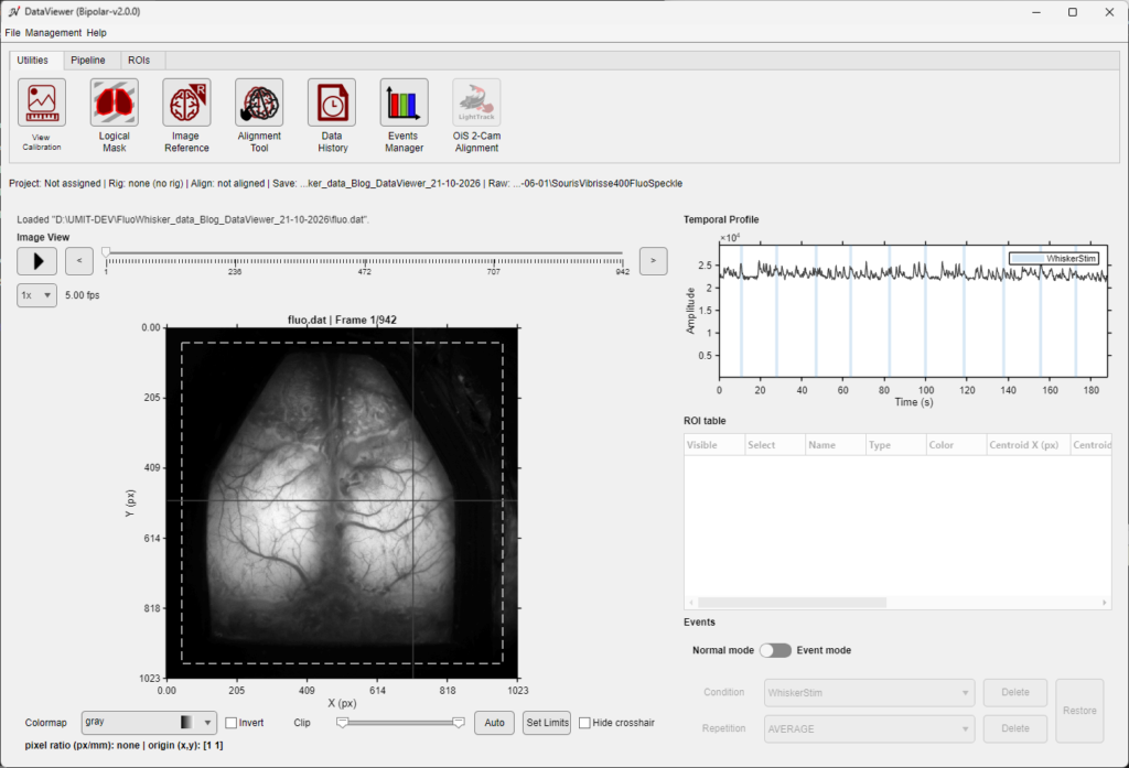 DataViewer_ bipolar-v2.0.0