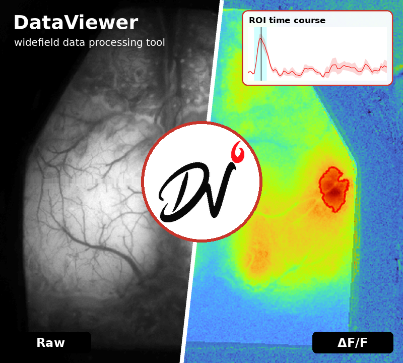 Raw and ΔF/F widefield images of the mouse cortex with the DataViewer logo and an ROI time course