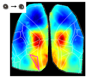 Cortical map during eye movement