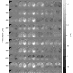 Adjusting the focus depth to enhance image quality of HbT signals